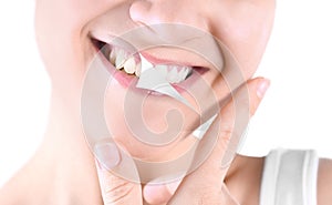 Smiling young woman before and after teeth whitening procedure on light background