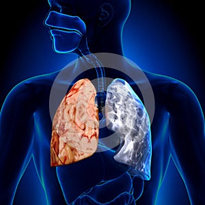 Smoker vs Non-smoker - Lungs Anatomy