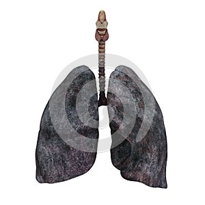 Smokers Lung Illustration