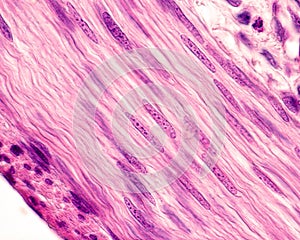 Smooth muscle cells. Nuclei