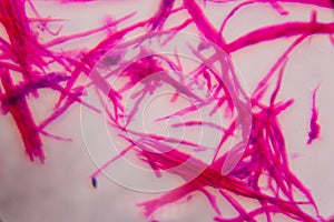 Smooth muscle separate under the microscope - Abstract pink line