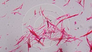Smooth muscle separate under the microscope - Abstract pink line