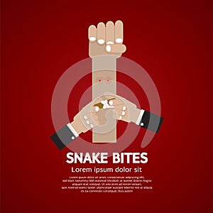 Snake Bites On Forearm