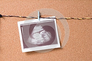 A snapshot of an ultrasound scan pinned to a rope on a cork board with a small wooden clothespin, pregnancy concept, find out the