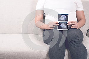 Soft focus and blurry of happy pregnant woman sitting on sofa at