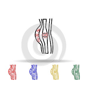 Soft-tissue injuries , pain multi color icon. Simple thin line, outline vector of plastic, surgery, epilation icons for ui and ux photo