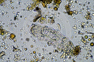 soil microbes in a compost on a farm in india