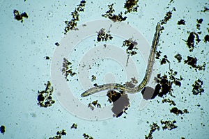 soil microbes in a compost on a farm in india