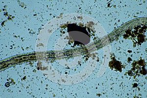 soil microbes in a compost on a farm in india