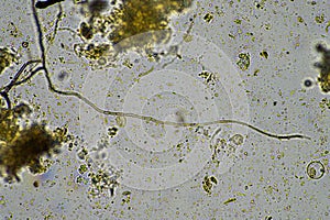 soil microbes under the microscope. microorganisms with fungus