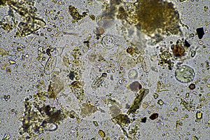 soil microbes under the microscope. microorganisms with fungus