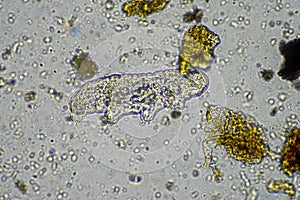 soil microorganisms including nematode, microarthropods, micro arthropod, tardigrade, and rotifers a soil sample, soil fungus and