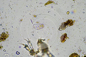 soil sample containing soil biology, with bacteria, fungi, amoeba, flagellate, and arcella, on a sustainable agricultural farm photo