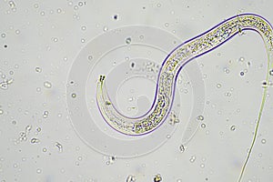 soil switcher nematode, microorganism and soil biology, with nematodes and fungi under the microscope. in a soil and compost