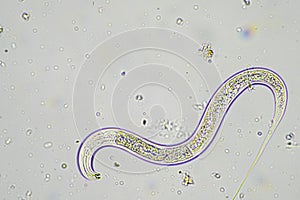 soil switcher nematode, microorganism and soil biology, with nematodes and fungi under the microscope. in a soil and compost