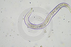 soil switcher nematode, microorganism and soil biology, with nematodes and fungi under the microscope. in a soil and compost