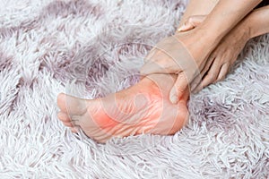Soles inflammation the human foot bones