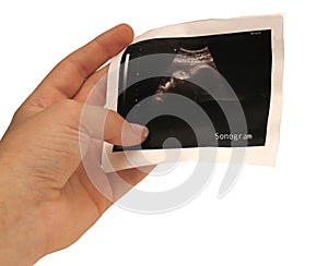 Sonogram photo