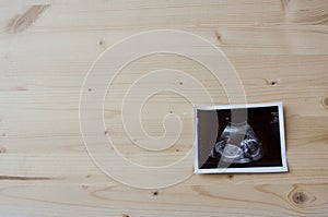 Sonogram on Wood Background