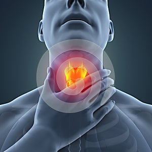 Sore Throat Illustration