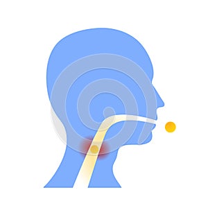 Sore throat inflammation remedy