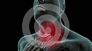 Sore throat pain in xray body