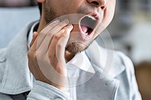 Sore Tooth And Decay. Man Dental Health