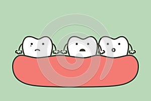 Spacing teeth diastema, dental problem