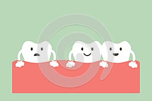 Spacing teeth diastema