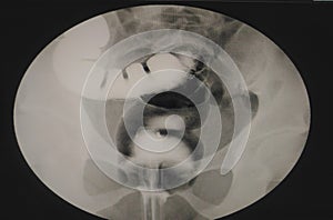 Specail x-ray