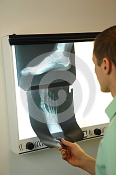 Specialist watching images of foot at xray film viewer