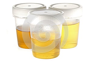 Specimen cups for urinalysis