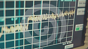 spectrum analyzer screen with megahertz decibels and other readings