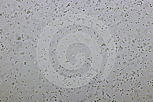 Sperm cells or spermatozoa in semen