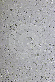 Sperm cells or spermatozoa in semen photo