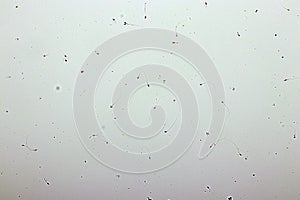 Sperm cells or spermatozoa in semen photo