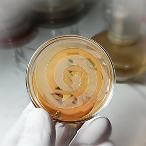 Sperm culture, petri dish with bacterial colony, semen culture
