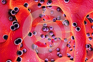 Spherical bacteria inside bone tissue