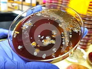 Sphingomonas, E. coli, Propionibacteria and Streptococcus on Chocolate Agar