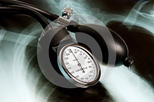 Sphygmomanometer on Xray photo