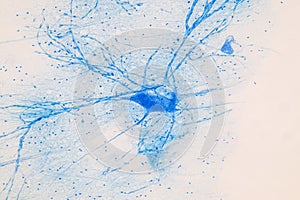 Spinal cord  and Motor Neuron under the microscope.