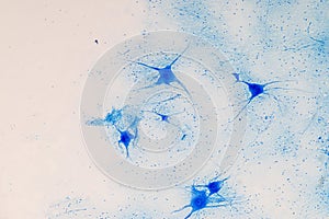 Spinal cord  and Motor Neuron under the microscope in Lab.