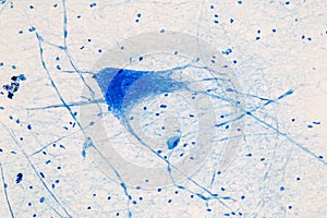 Spinal cord, Nerve, Cerebellum, Cortex and Motor Neuron Human under the microscope.