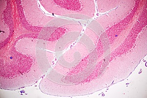 Spinal cord, Nerve, Cerebellum, Cortex and Motor Neuron Human under the microscope.