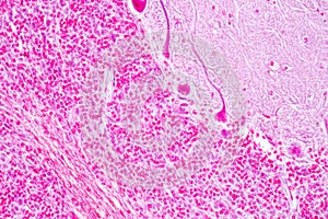 Spinal cord, Nerve, Cerebellum, Cortex and Motor Neuron Human under the microscope.