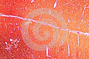 Spinal cord, Nerve, Cerebellum, Cortex and Motor Neuron Human under the microscope.