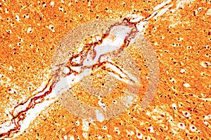 Spinal cord, Nerve, Cerebellum, Cortex and Motor Neuron Human under the microscope.