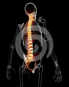 Spinal cord with pain