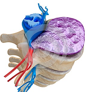 Spinal cord under pressure of bulging disc