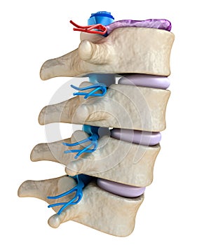 Spinal cord under pressure of bulging disc